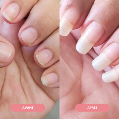 Nailz™ - Stylo de Croissance des Ongles